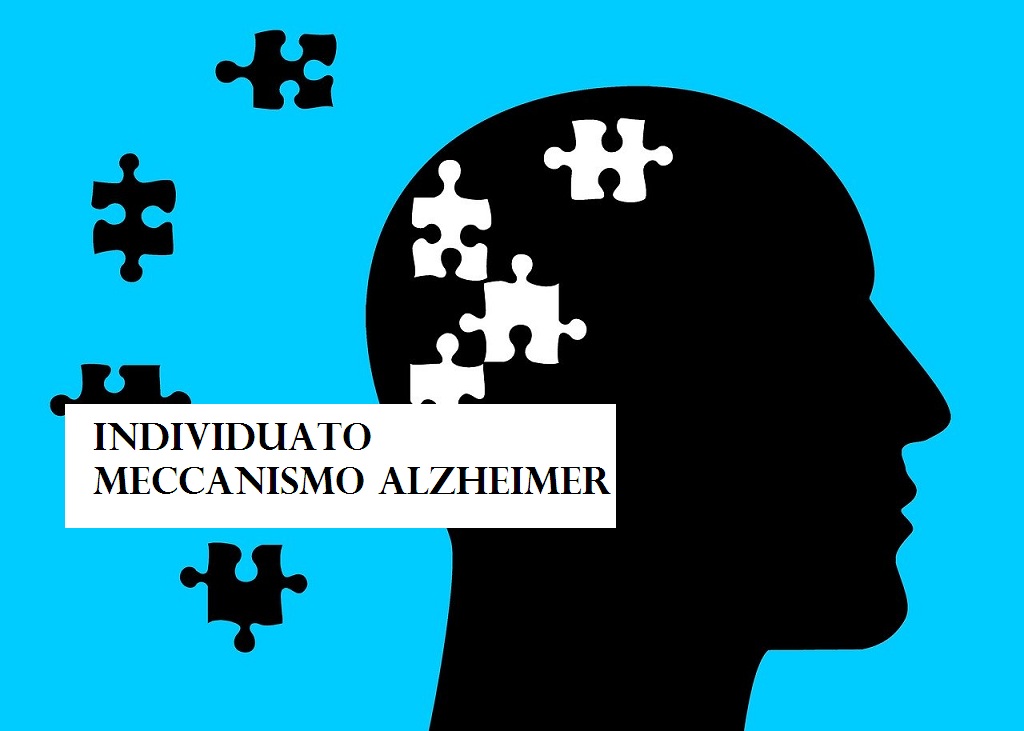Individuato meccanismo Alzheimer