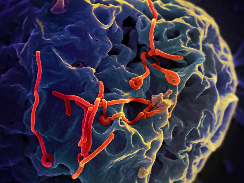 Rivelato come il virus Ebola