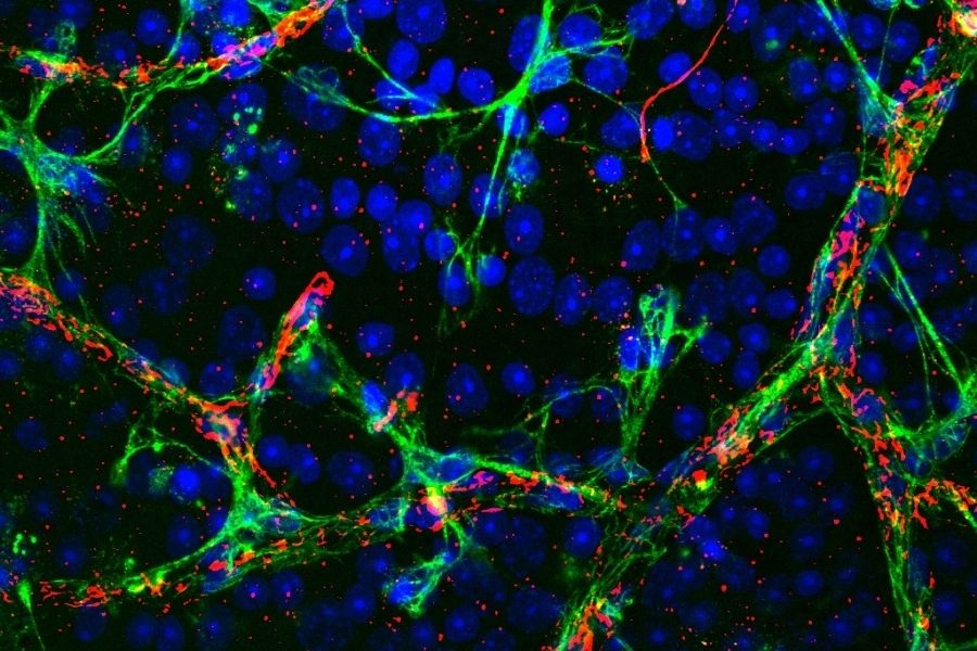 Microglia: impedire la riproduzione frena l'Alzheimer